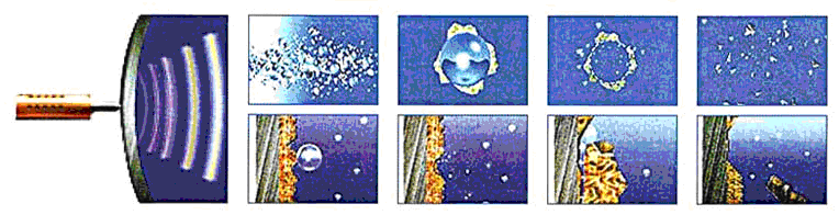 Mô tả cách phá cáu cặn lò hơi bằng sóng siêu âm.